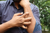 Juckende Haut am Arm