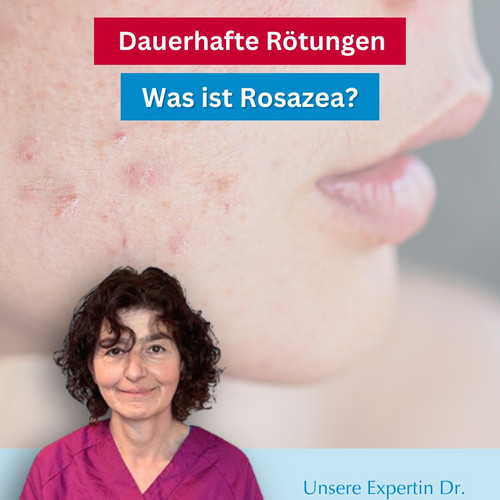 Immer wieder rote Wangen, Brennen oder ein Spannungsgefühl im Gesicht? 😳

Viele Betroffene halten die Beschwerden...